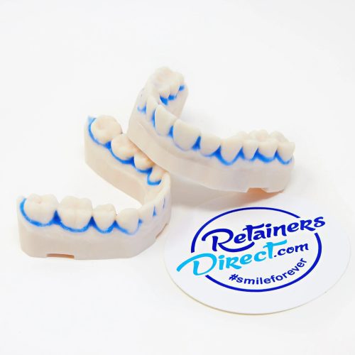 3D printed models Retainers Direct